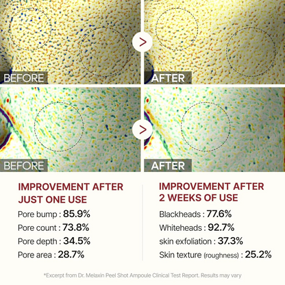 Pack of 2 Dr. Melaxin Peel Shot Exfoliant Rice Ampoule